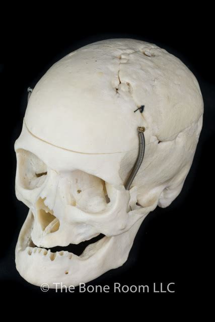 Real Human Skulls For Sale The Bone Room