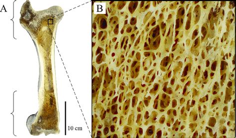 Cancellous Bone Occurrence And Macrostructure As Illustrated Here With