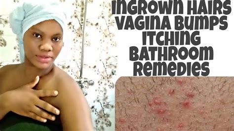 How To Stop Ingrown Hairs Itching Vagin L Bumps From Shaving Waxing Shaving Tips For