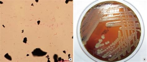 Figure 1the First Korean Case Of Sphingobacterium