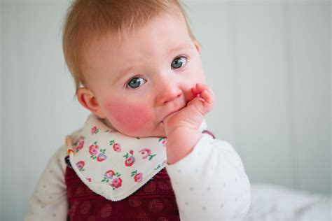 Are Red Cheeks A Sign Of Teething