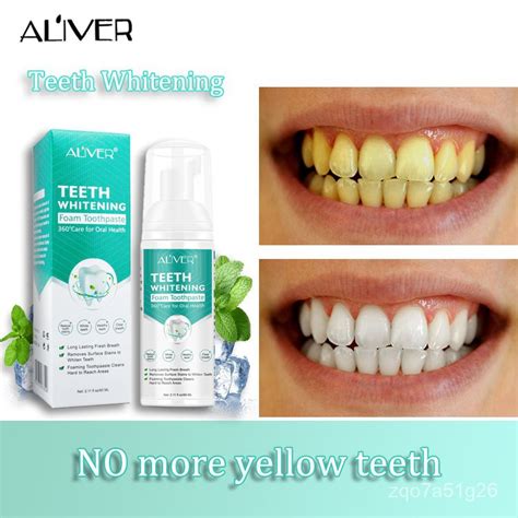 Aliver Whitening Toothpaste To Remove Stains Mousse Foam Teeth