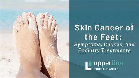 Skin Cancer Of The Feet Symptoms Causes And Podiatry Treatments