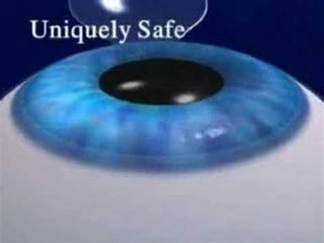 Intralase Lasik Custom Lasik At Eye Doctors Of Washington Dc Youtube