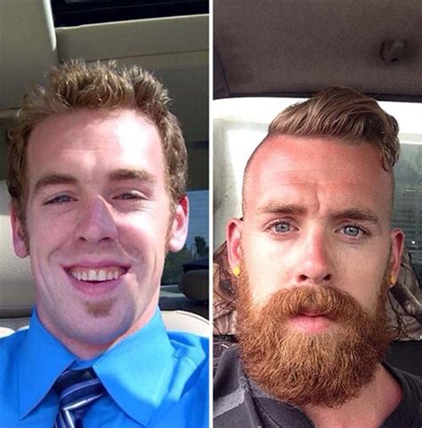 Insane Before And After Beard Transformations 32 Photos