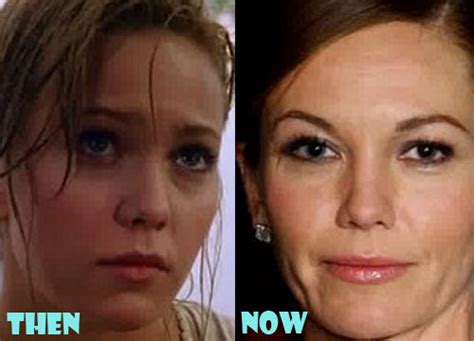 Diane Lane Plastic Surgery Before And After Photos Lovely Surgery