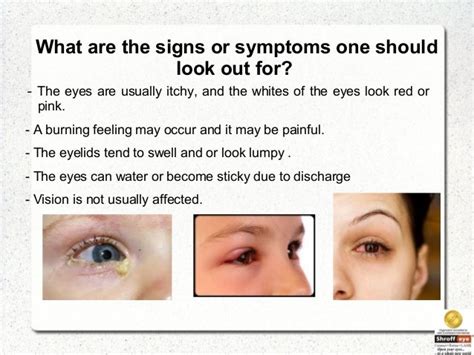 What Are The Symtoms And Precautions Of Conjunctivitis