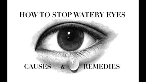 How To Stop Watery Eyes Youtube
