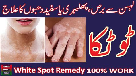 White Spots Treat From Garlic Remedy Nayab Totka Expert Youtube