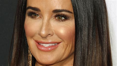 kyle richards opens up about whether or not she s ever had any work done on her face