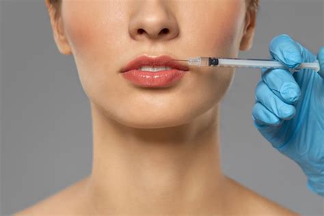 5 Tips To Make Lip Filler Last Longer Answers From An Expert Injector