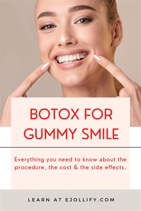 Botox For Gummy Smile The Complete Guide Botox Injection Side Effects