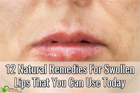 12 Natural Remedies For Swollen Lips That You Can Use Today Home Remedies