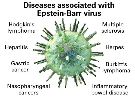 Identifying Genomic Mutations Linked To Epstein Barr Virus Induced Lymphoma