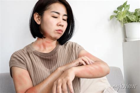 Asian Woman Has Allergic To Her Own Sweat Hand Scratching Itchy