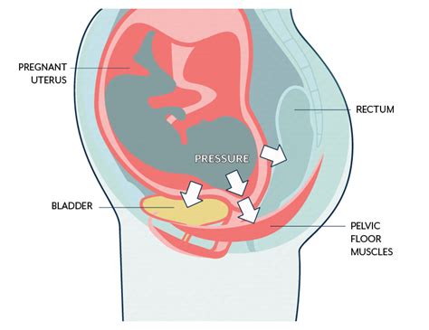 Urinary Incontinence Pelvic Floor Disorders Goop Hot Sex Picture