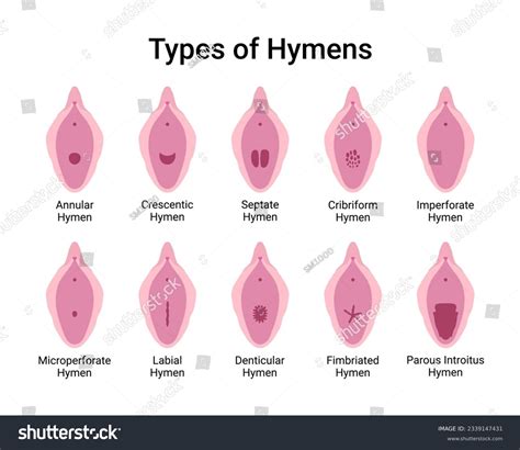 Hymen Photos And Images Shutterstock