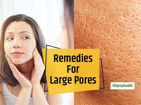 Skincare Home Remedies Get Rid Of Large Pores On The Face With These