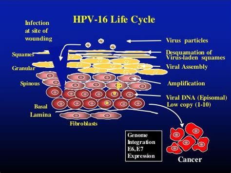 Ppt Genital Human Papillomavirus Hpv Infection Powerpoint Hot Sex Picture