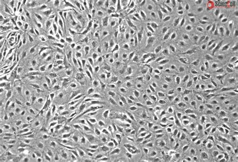 Human Intestinal Microvascular Endothelial Cells Himec