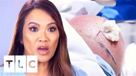 She provides services such as botox, fillers, liposuction, eye lifts and skin cancer surgery. I Can't Watch! | Dr. Pimple Popper - YouTube