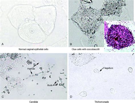 Microscopic Examination Of Vaginal Samples A Normal Grepmed