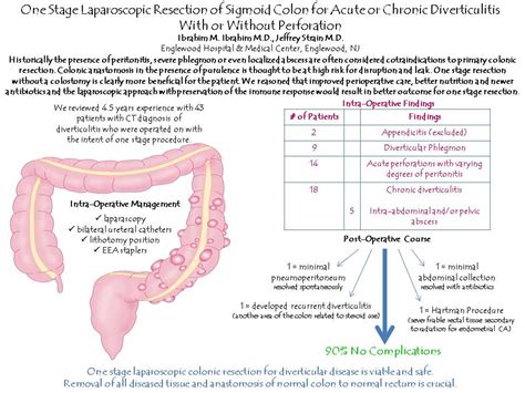 One Stage Left Colon Resection For Chronic And Acute Diverticulitis