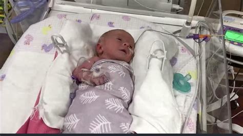 Baby Girl Born At 34 Weeks At 3 Pounds 2 Oz Due To Pre Eclampsia R