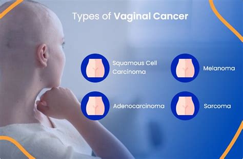 Read About The Vaginal Cancer Types And Its Symptoms Flickr