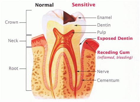 what causes sensitive teeth dr nechupadam dental clinic