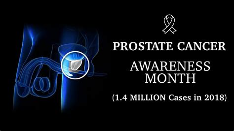 PROSTATE CANCER AWARENESS How To Prevent Prostate Cancer YouTube