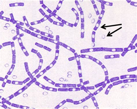 Microbiology Lecture 25 Gram Positive Rods Flashcards Quizlet