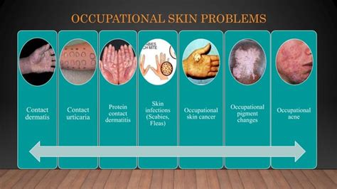 Occupational Skin Diseases