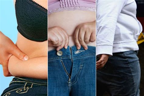 Two Million Obese Brits To Get Free Gastric Band Operations On The Nhs
