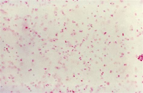 Neisseria gonorrhoeae and neisseria meningitidis are both gram negative bacteria. Neisseria Gonorrhoeae - howMed