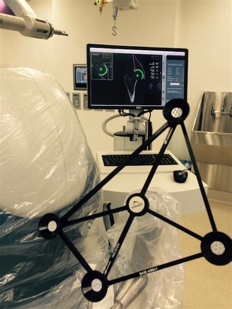 Mako Robotic Orthopaedic Surgery Technology Murdoch Orthopaedic Clinic