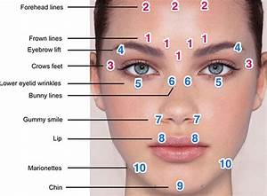 Image Result For Botox Injection Sites Chart Facial Fillers Botox