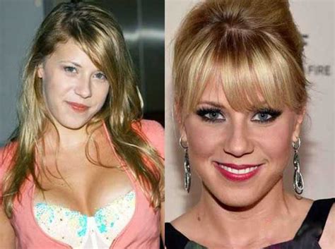Jodie Sweetin Plastic Surgery Boobs Boob Job Botox Cheek Filler
