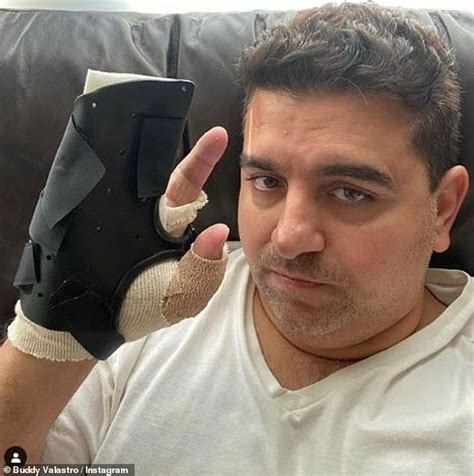 Cake Boss Star Buddy Valastro Shows Off His Scarred Right Hand For The