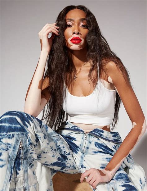 Winnie Harlow Takes A Bow As The Changing Face Of Beauty By Dennis