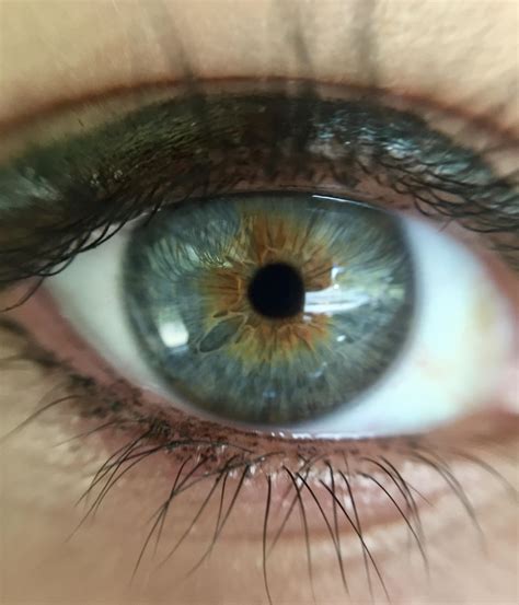 Macro Of My Eye Central Heterochromia Rheterochromia