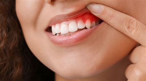 Why Gum Disease Could Be More Serious Than You Think