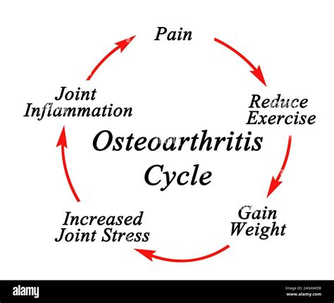 Five Components Of Osteoarthritis Cycle Stock Photo Alamy