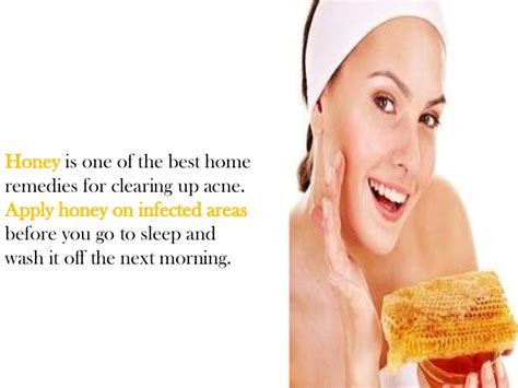Best Acne Treatment Home Remedies Dorothee Padraig South West Skin