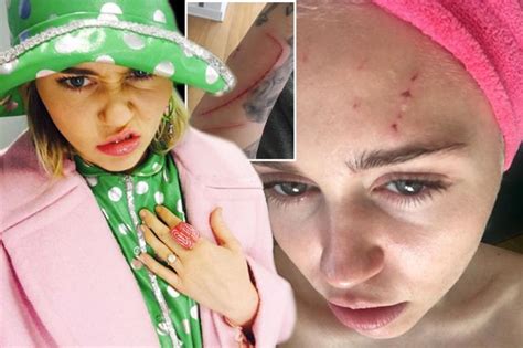 Miley Cyrus Reveals Nasty Injuries After Being Clawed By A Cat Mirror