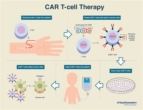Car T Cell Therapytenas