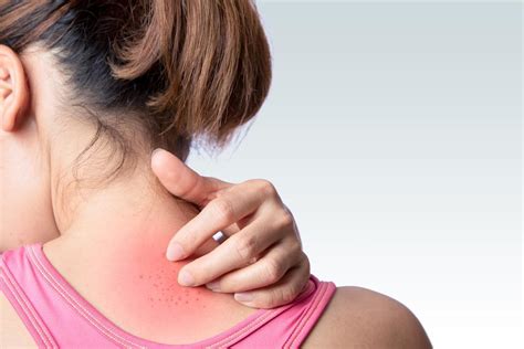 Itchy Skin How To Treat A Rash Chappell Rosso Dermatology And The