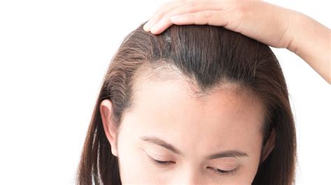 However, even if you don't know the cause, there are in order to determine the underlying cause, you may want to see a naturopathic doctor who can help you by getting appropriate blood tests to find out why your hair is thinning. How to Stop and Regrow a Receding Hairline: Best ...