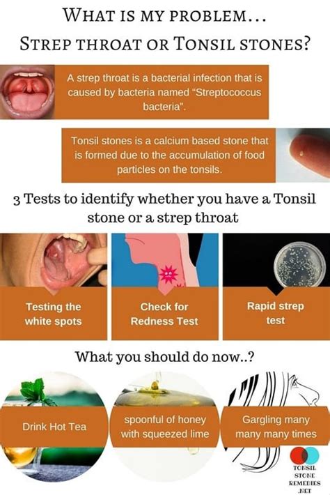 What Is My Problem Strep Throat Or Tonsil Stones