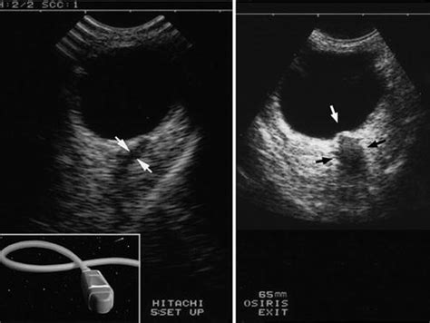Whole Body Ultrasound In The Critically Ill Lung Heart And Venous